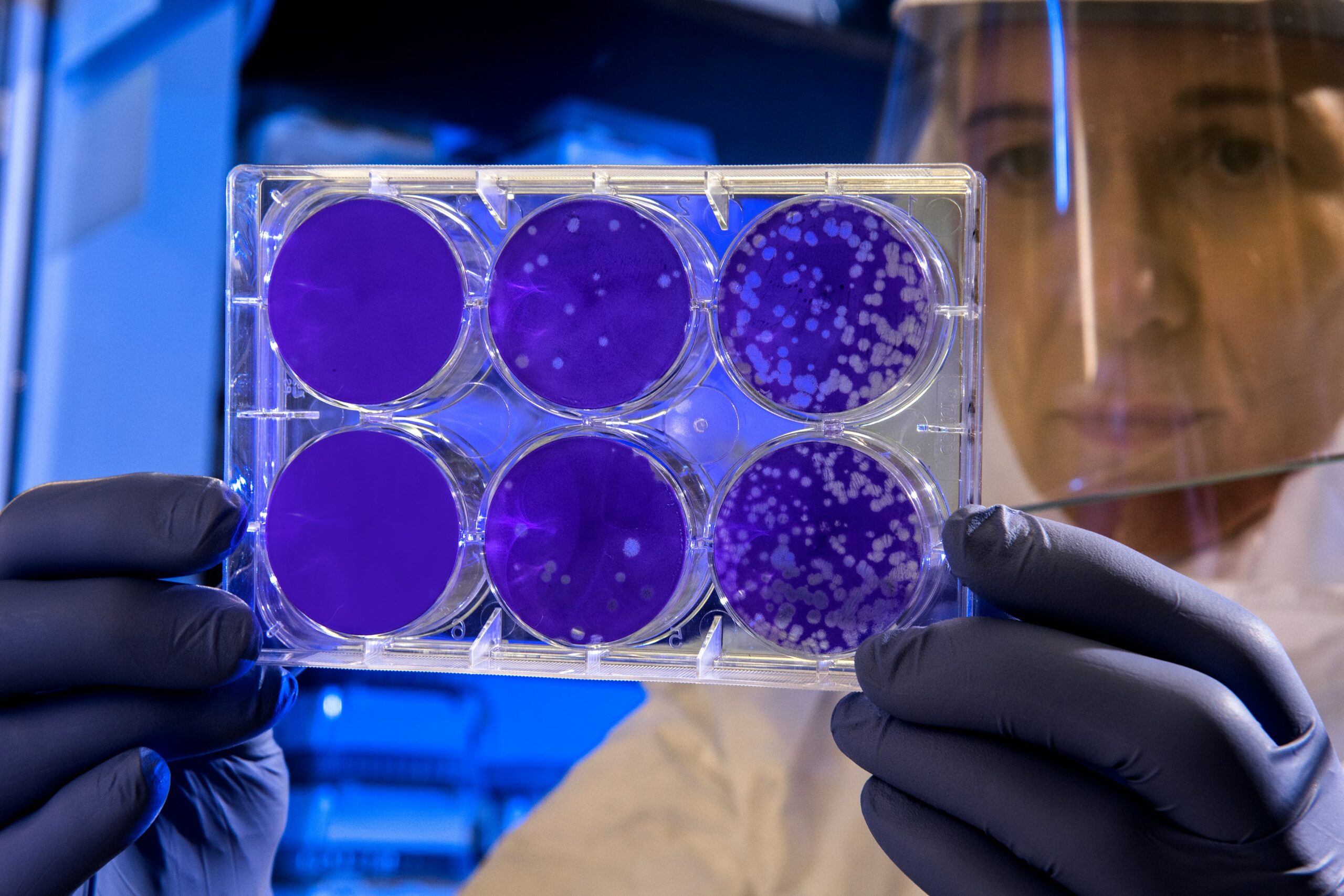 laboratory scientist examines a tray of blue petri dishes